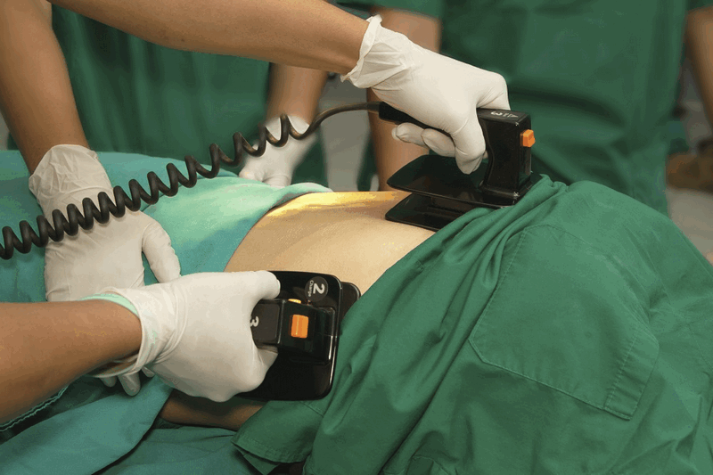 Defibriliacija gelbsti gyvybę 